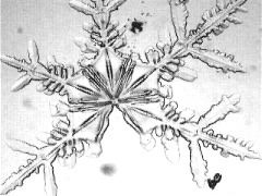 dendrites